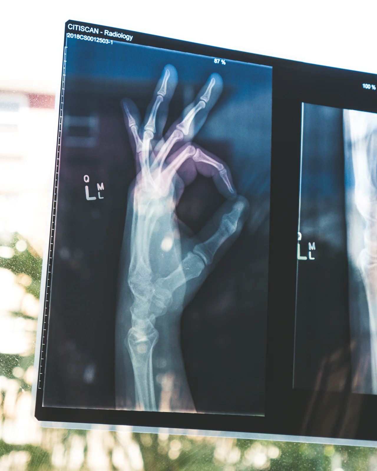Structura unei lucrări academice în Medicină